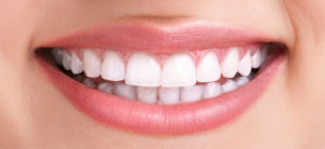 teeth cleaning and teeth whitening