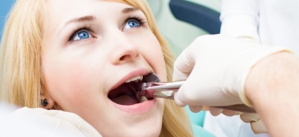 TOOTH EXTRACTION