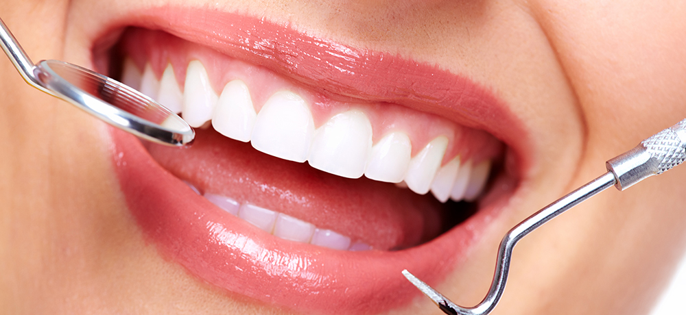 Dental Cleaning And Teeth Whitening