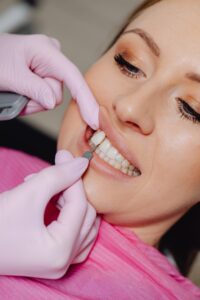How to Dramatically Improve your Smile with Veneers