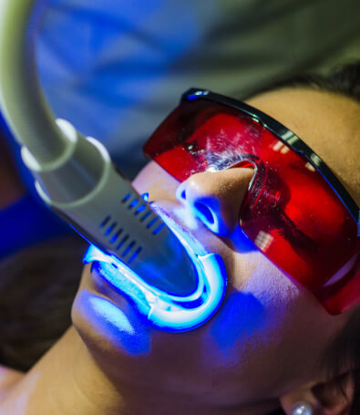 Laser Dentistry Tools