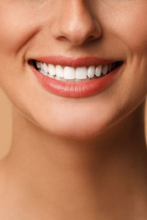 Minimal tooth preparation