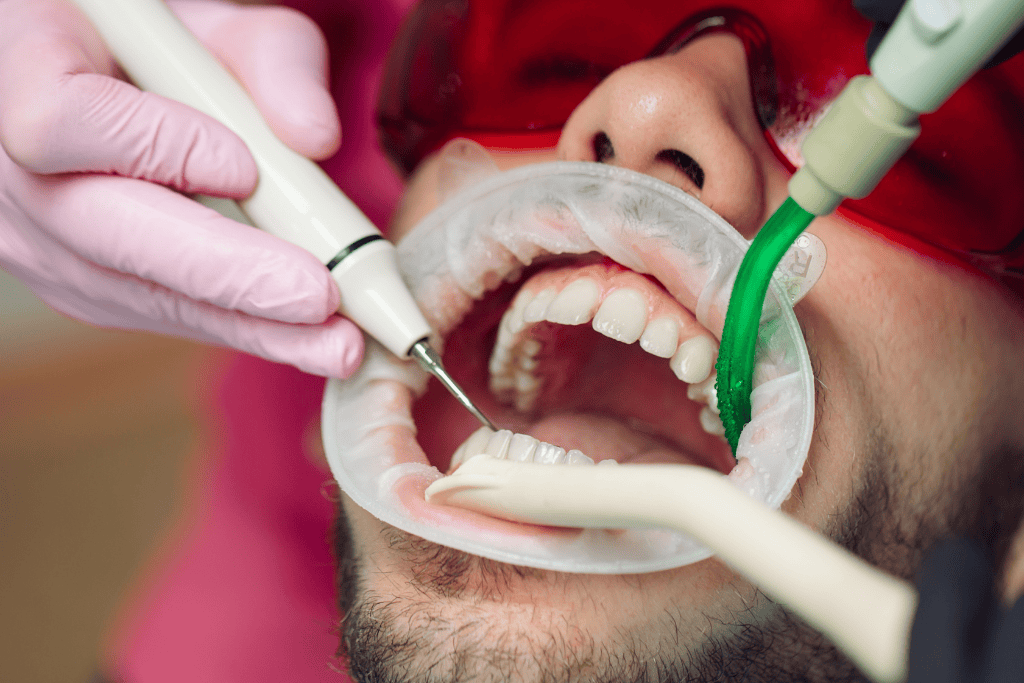 The Benefits of Regular Teeth Cleaning for Long-Term Oral Health