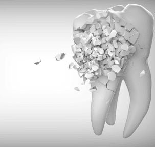 Symptoms of a Cracked Tooth