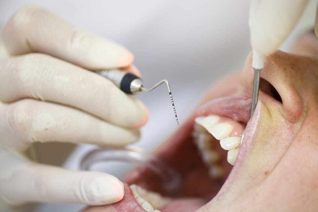 What to Expect from a Periodontal Treatment in Brampton
