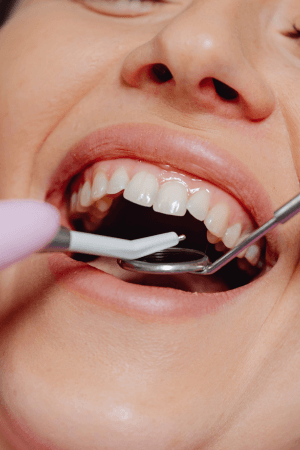 Restorative Treatments