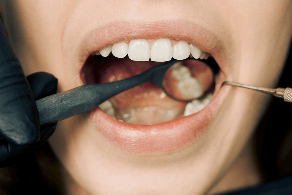 The Importance of Oral Cancer Screenings