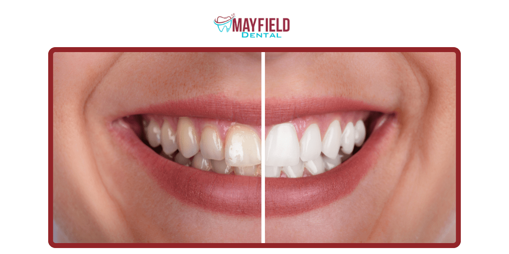 What Happens During Teeth Cleaning