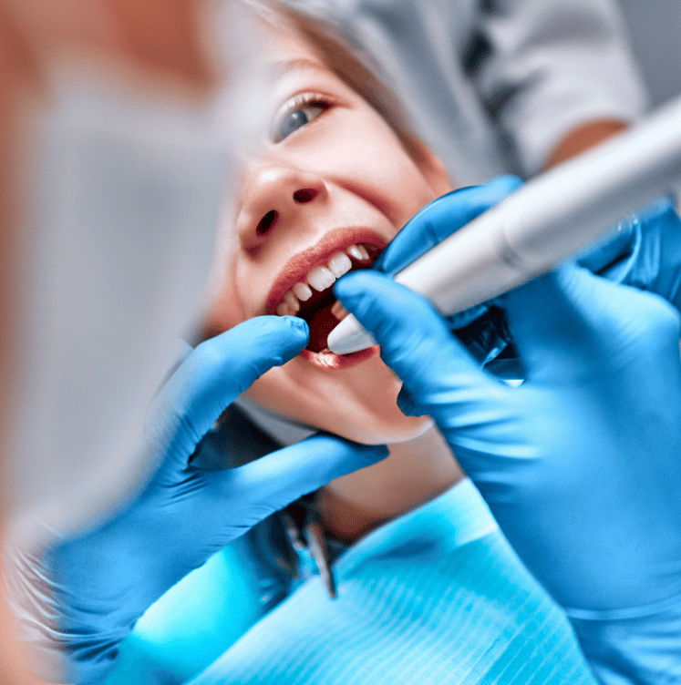 Dental Sealants for Kids brampton