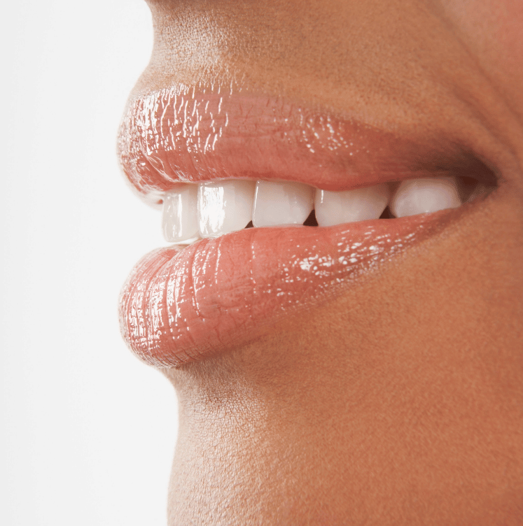 Full Mouth Reconstruction brampton