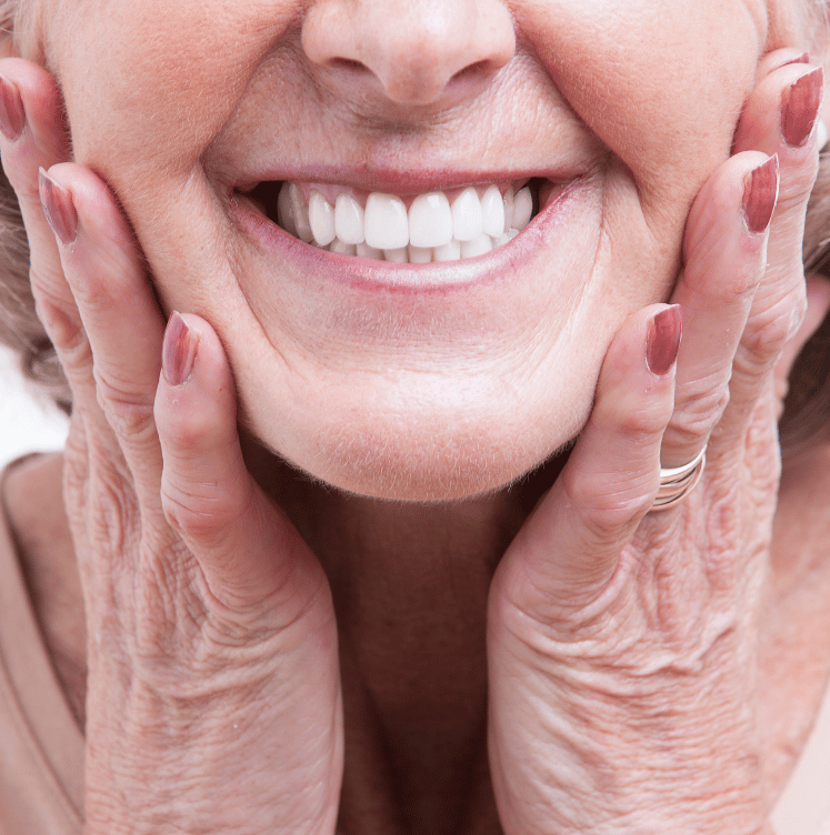 Implant-Supported Dentures brampton