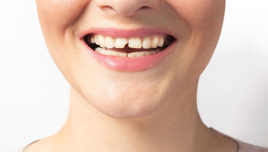 emergency dental brampton