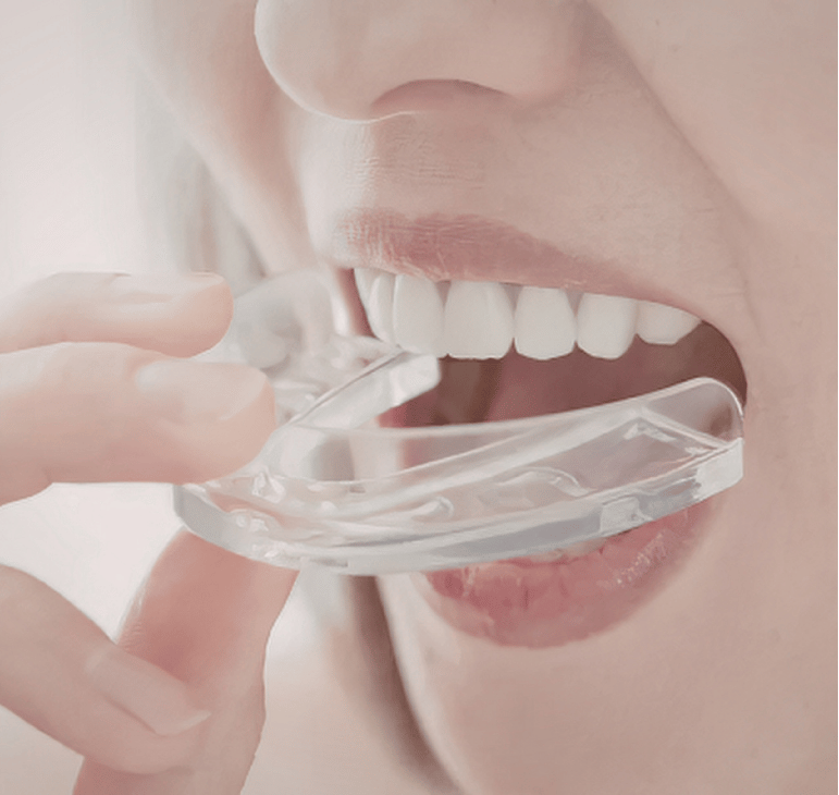 Night Guards for Teeth Grinding