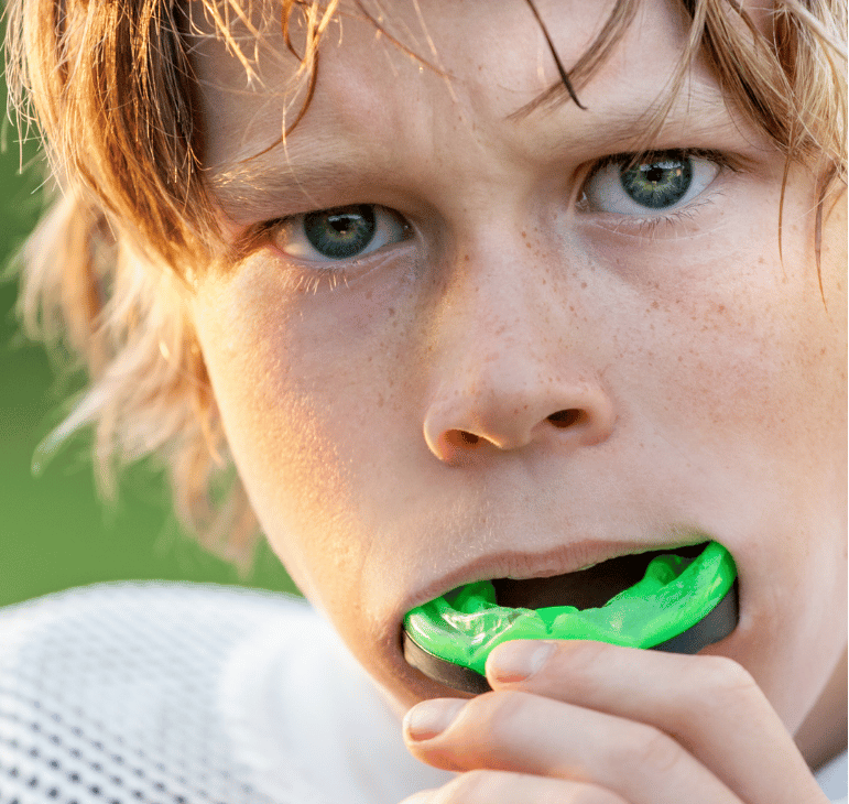 Sports Mouth Guards brampton ontario