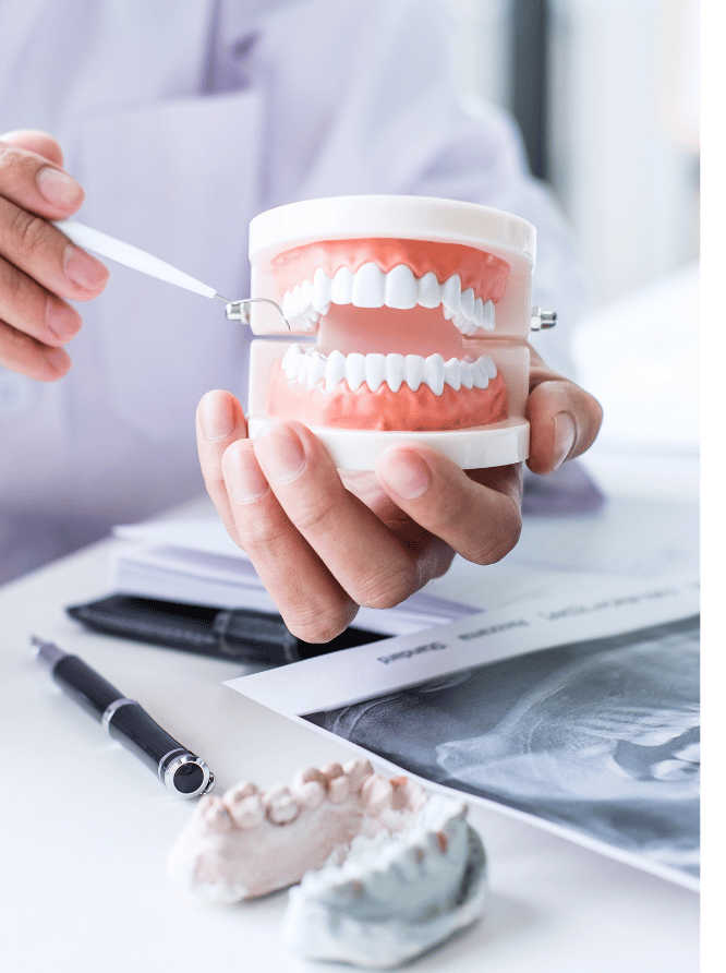 Dental Bridges in Brampton