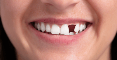 emergency dental brampton